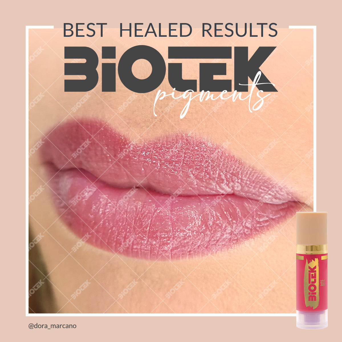 Zaceljen rad sa Biotek BITE nijansom pigmenta za usne.
